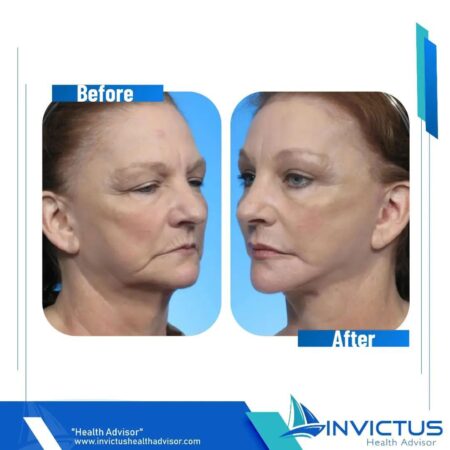 invictushealthadvisor (1)