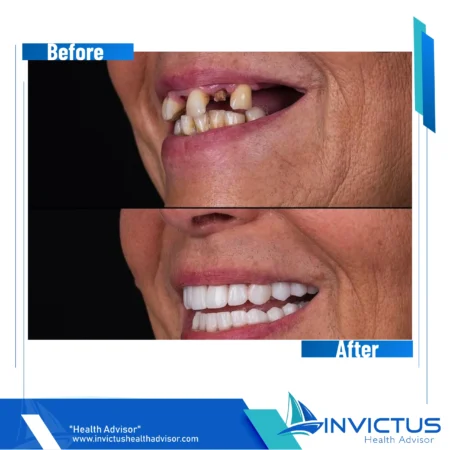 invictus-dental-03