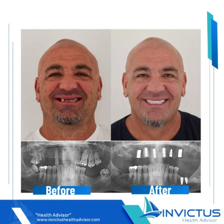 invictus-dental-05