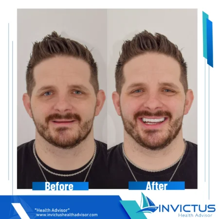 invictus-dental-06